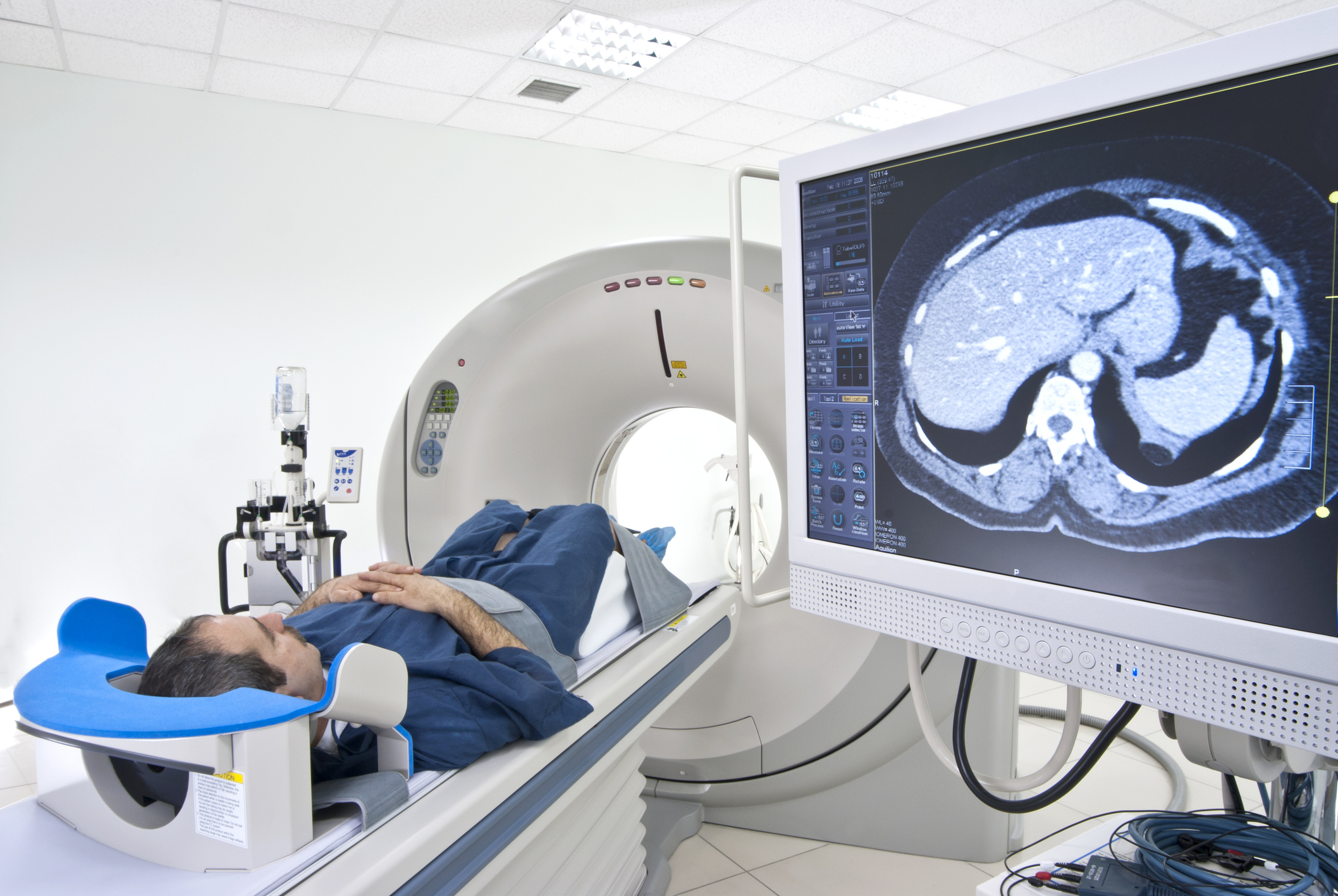 Tomografia computadorizada: conheça os riscos e benefícios do exame